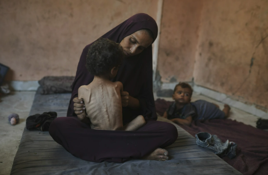 Naima Abu Ful posa para uma foto com seu filho desnutrido de 2 anos, Yazan, em sua casa no campo de refugiados de Shati, na Cidade de Gaza, quarta-feira, 23 de julho de 2025. (AP Photo/Jehad Alshrafi)